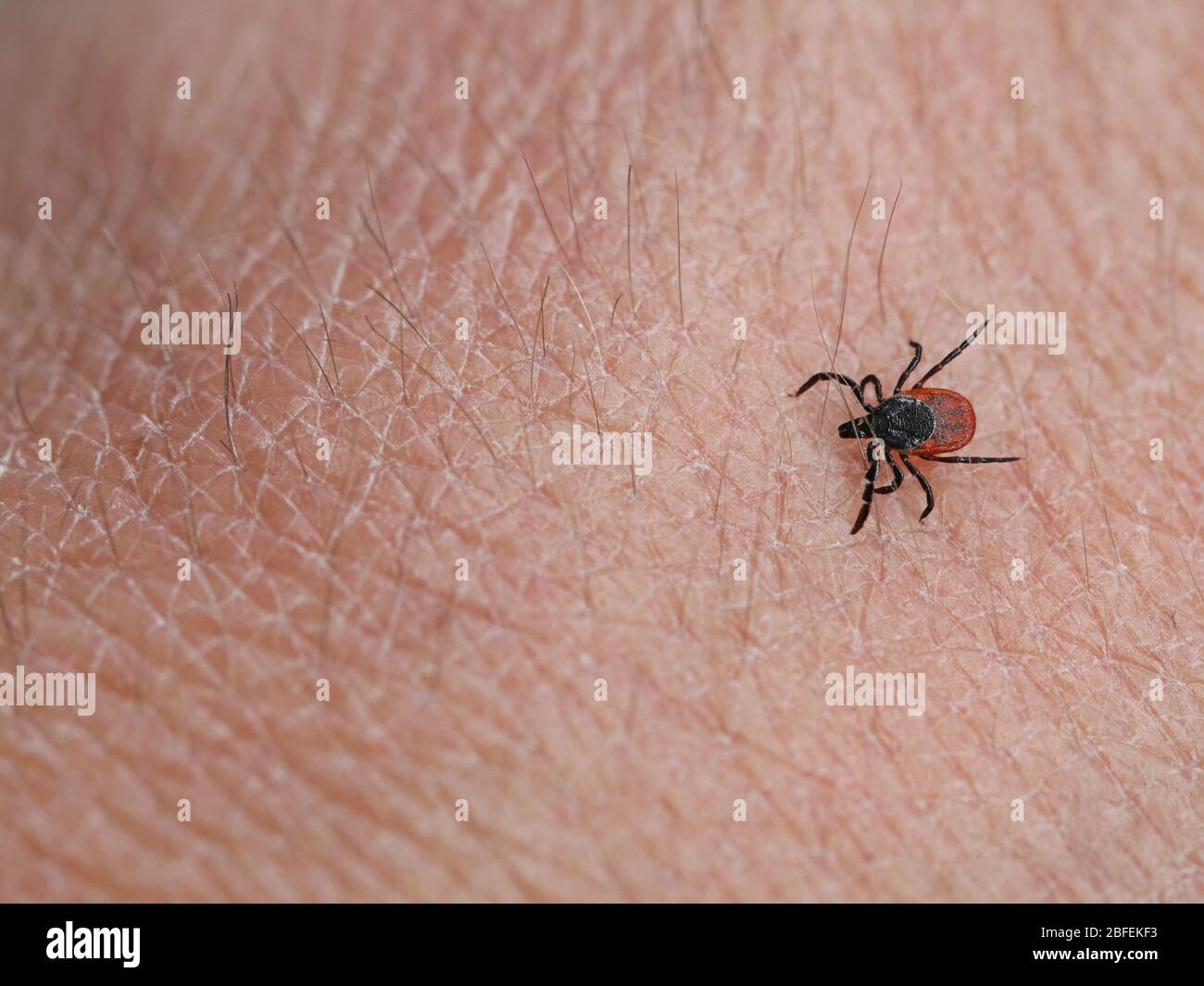 deer tick, ixodes ricinus, on human skin background with copy space Stock Photo