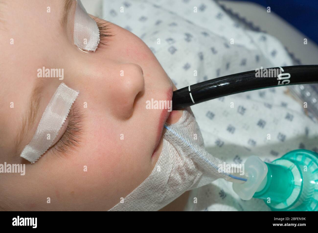 Young child undergoing endoscopic examination. Stock Photo