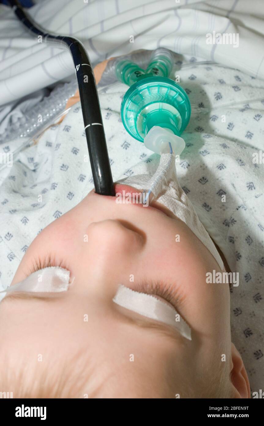 Young child undergoing endoscopic examination. Stock Photo