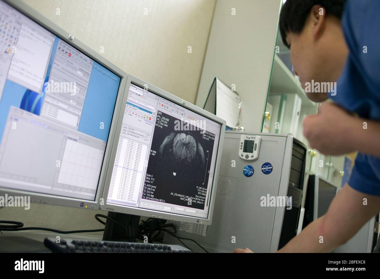 A medical Reseacher examines the on screen image of a mouse brain Stock ...