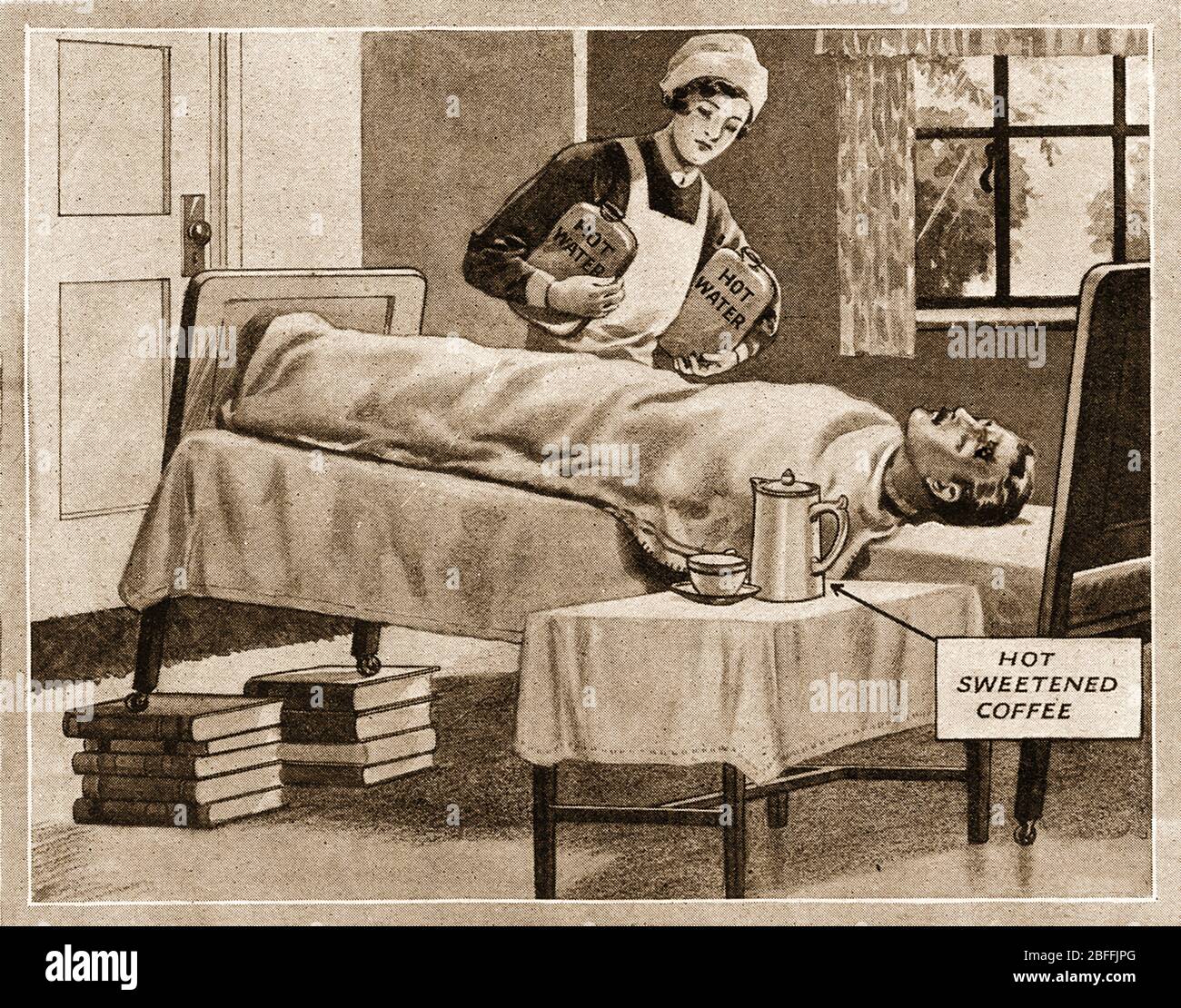 https://c8.alamy.com/comp/2BFFJPG/a-1940s-illustration-showing-how-to-treat-a-patient-for-shock-using-hot-water-bottles-coffee-and-raising-the-the-bed-at-one-end-with-books-2BFFJPG.jpg