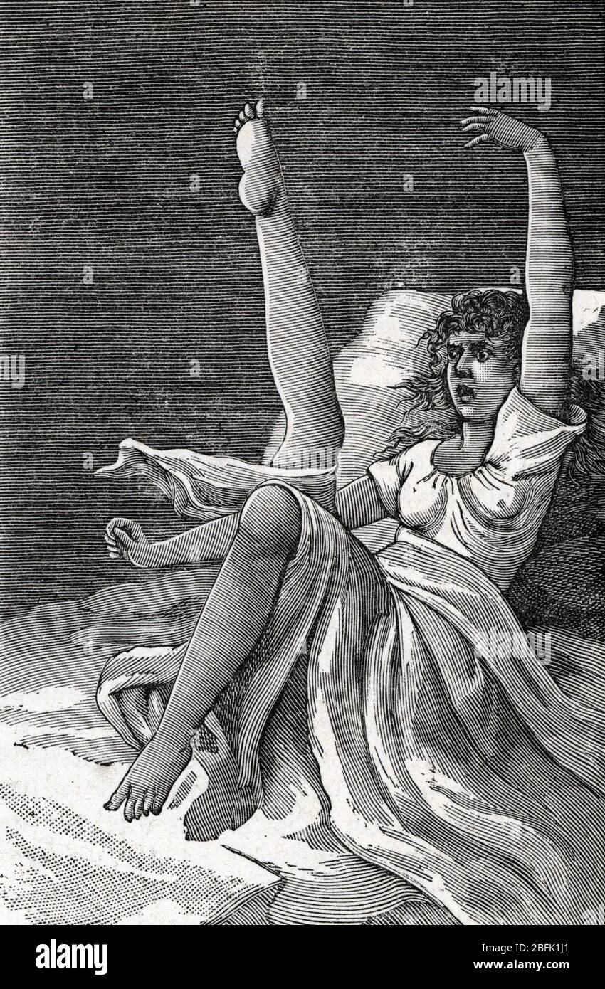 Representation de l'attitude d'une femme hysterique en pleine crise