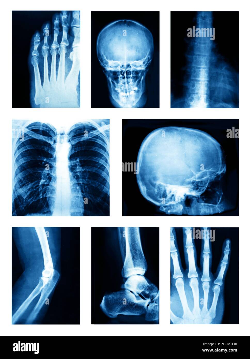 Collage of many Xrays Stock Photo Alamy