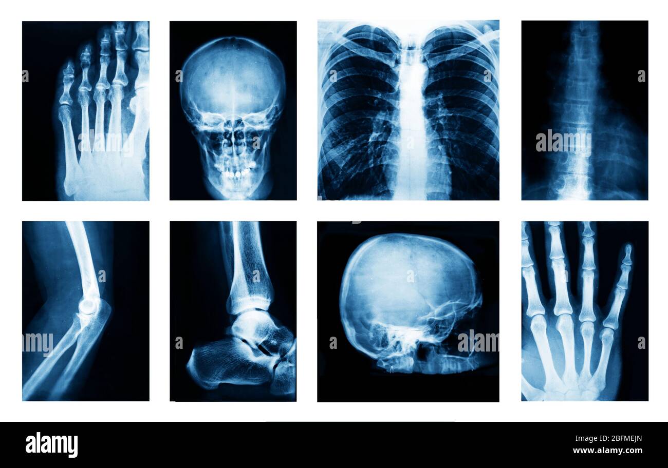 Collage of many Xrays Stock Photo Alamy