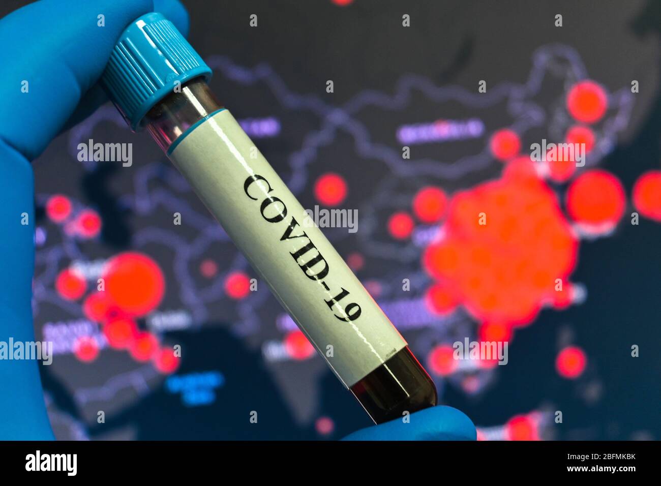Detection of the coronavirus, the pathogen of the disease COVID-19. Blood test tube for testing for SARS-CoV-2. Stock Photo