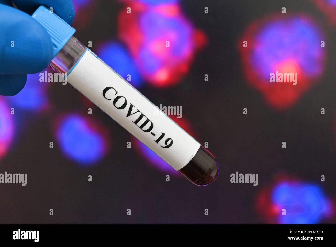Detection of the coronavirus, the pathogen of the disease COVID-19. Blood test tube for testing for SARS-CoV-2. Stock Photo