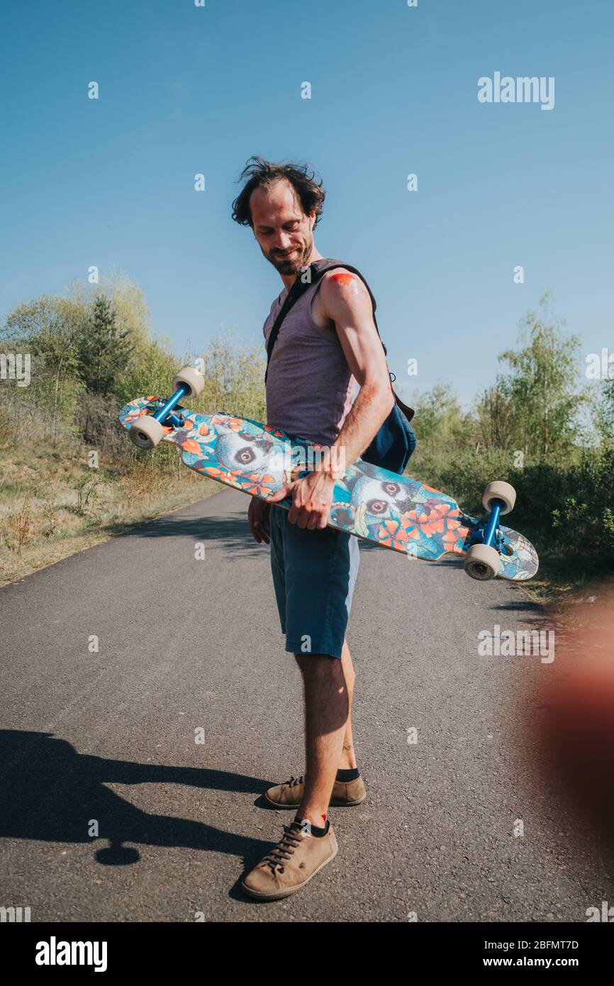 man with abrasion on shoulder and arm after skateboard accident Stock Photo  - Alamy