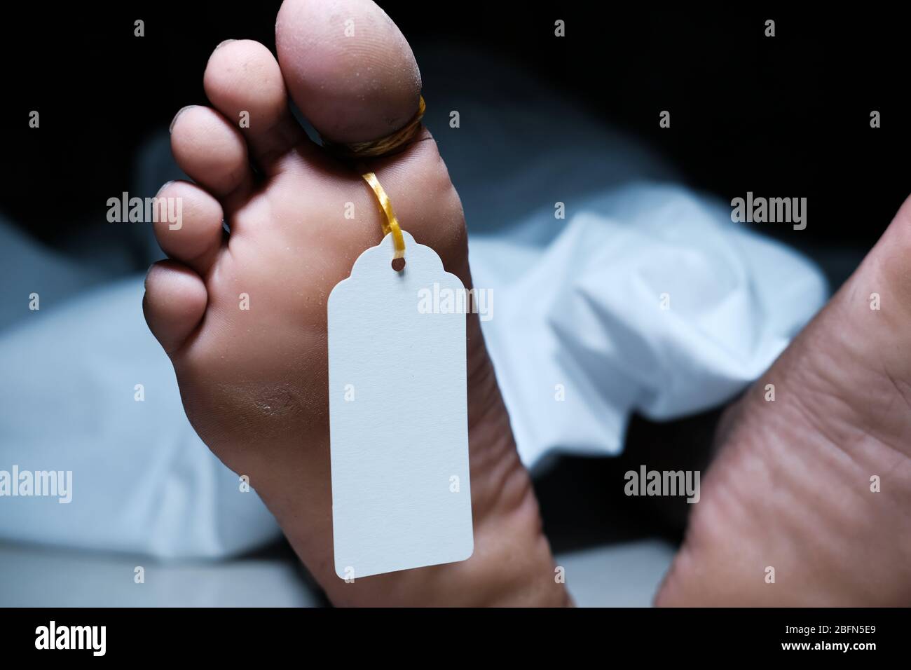 Two feet of a dead body with a tag attached to the toe Stock Photo