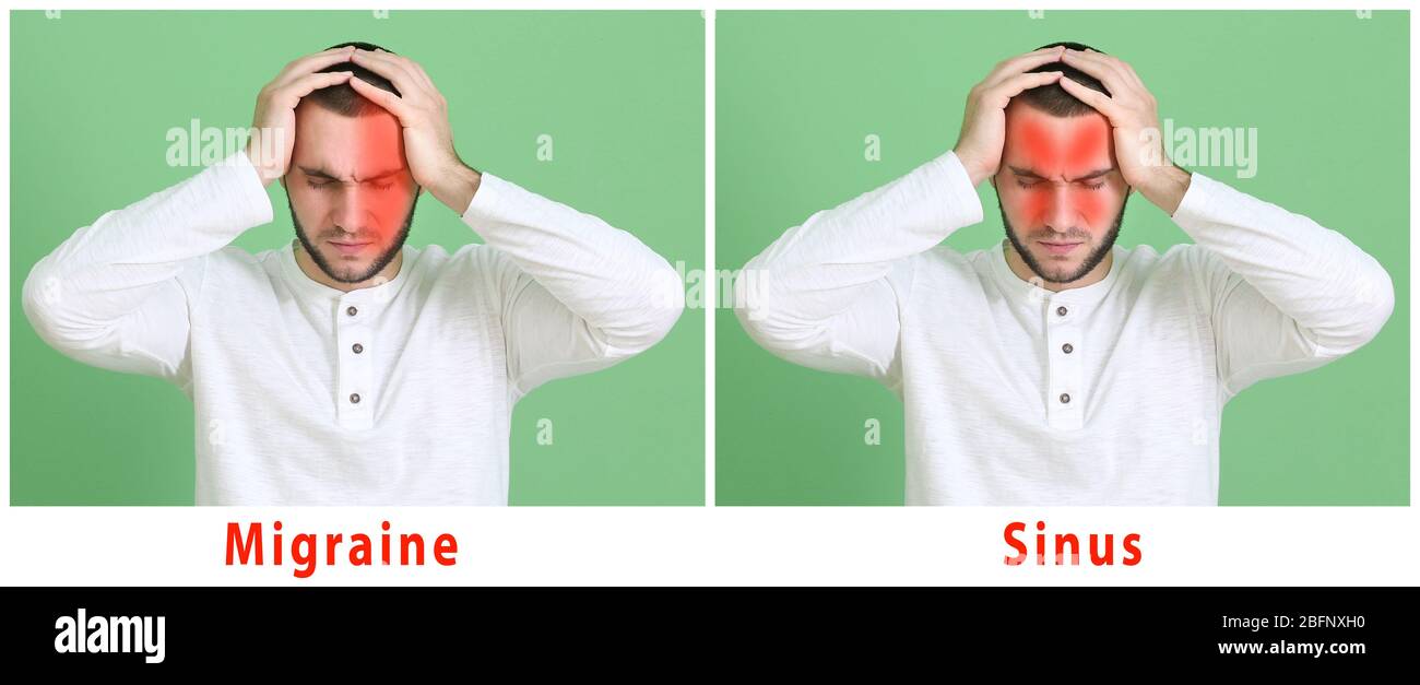 Young man with different types of headache on color background Stock Photo