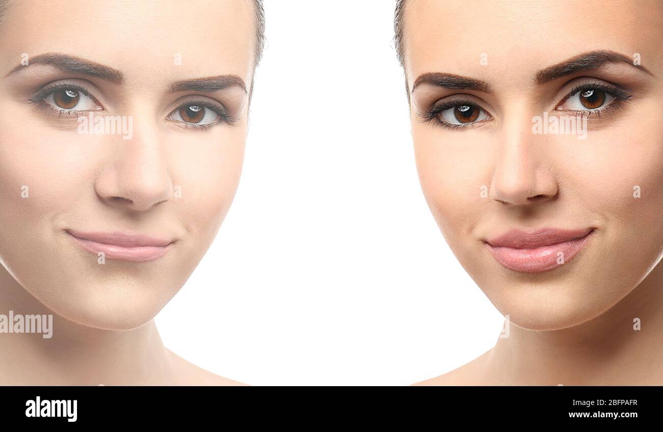 Woman face before and after cosmetic procedure. Plastic surgery concept