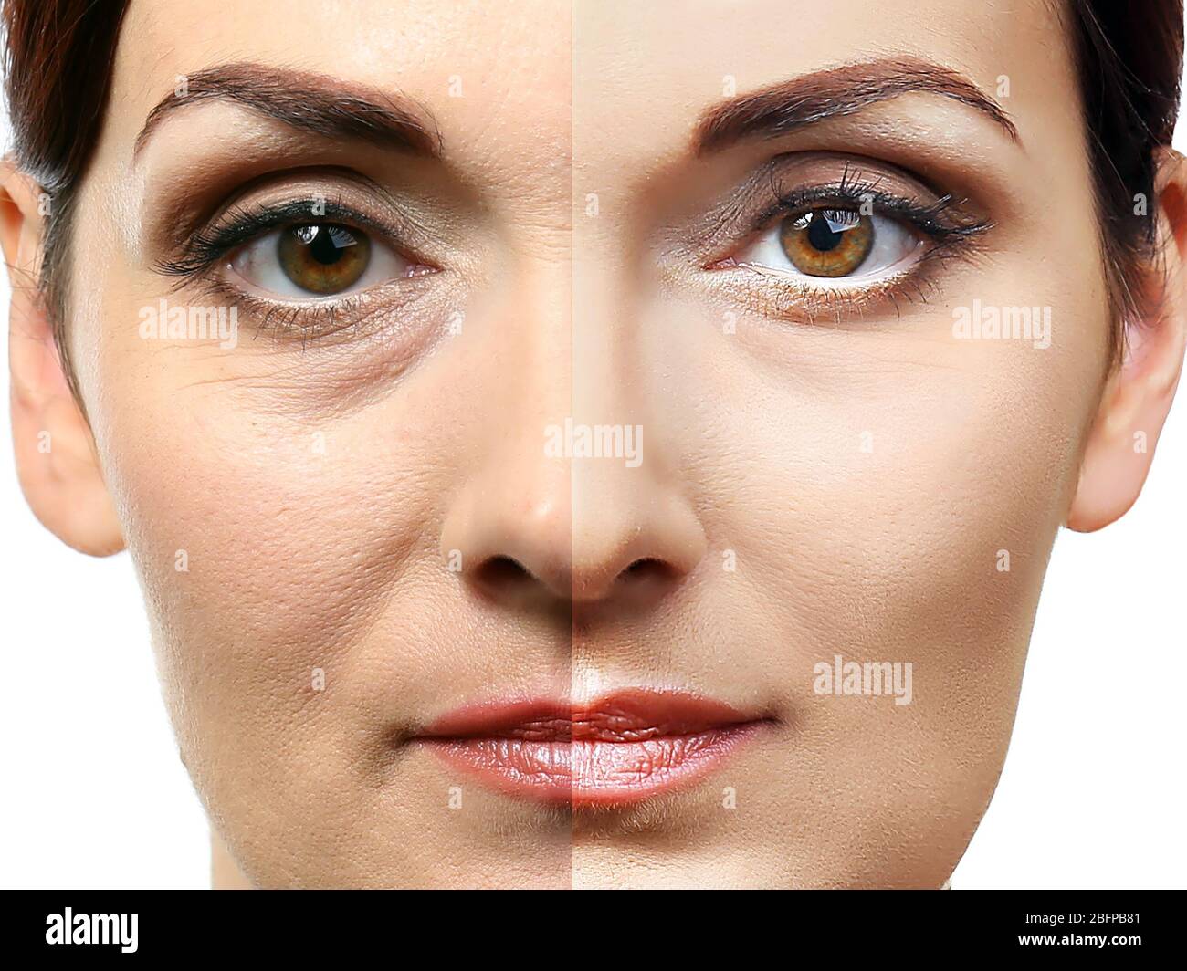 Woman before after face lift hires stock photography and images Alamy