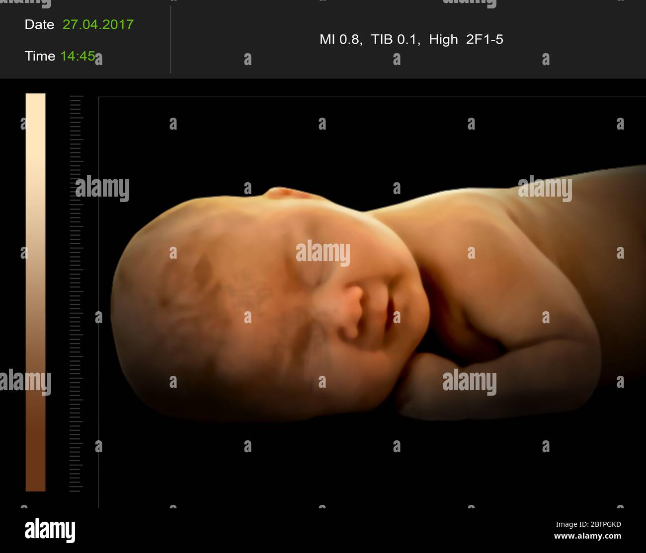 Ultrasound photography hi-res stock photography and images - Page 3 - Alamy