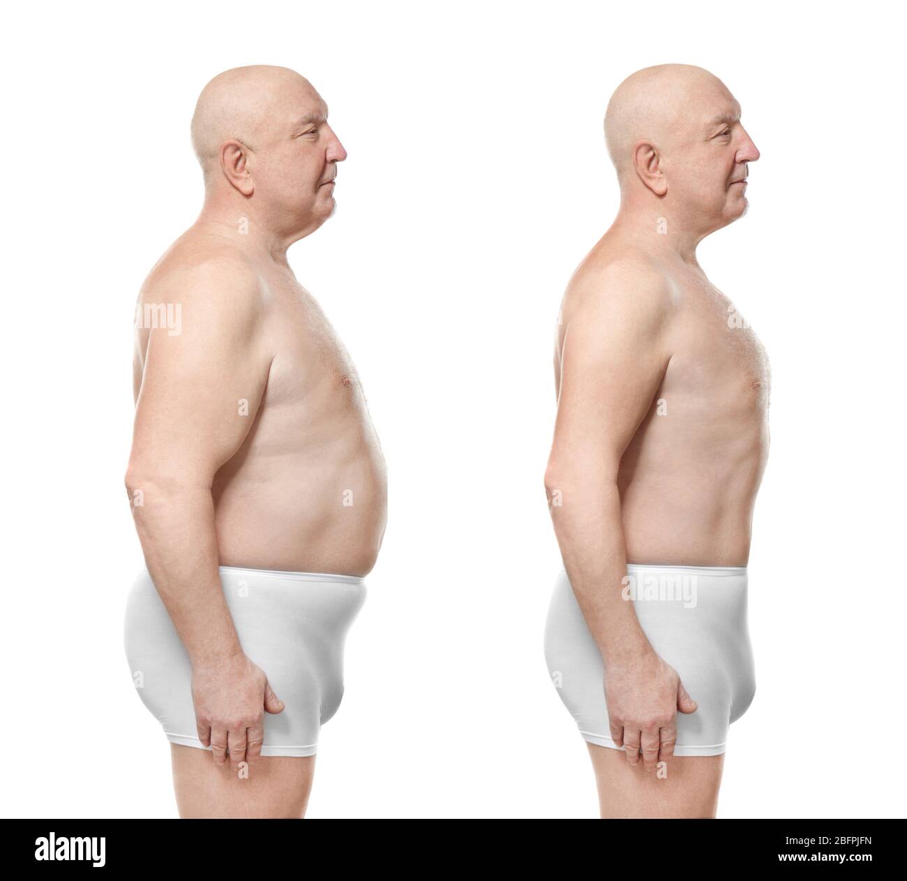 Weight Loss Before After Man Images – Browse 1,665 Stock Photos