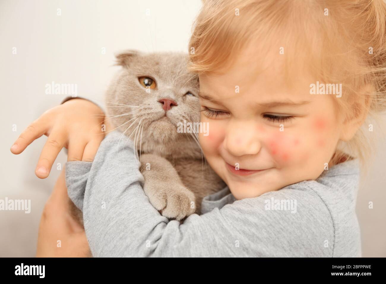 Little girl with red rash embracing pet, closeup. Concept of allergies to cats Stock Photo Alamy