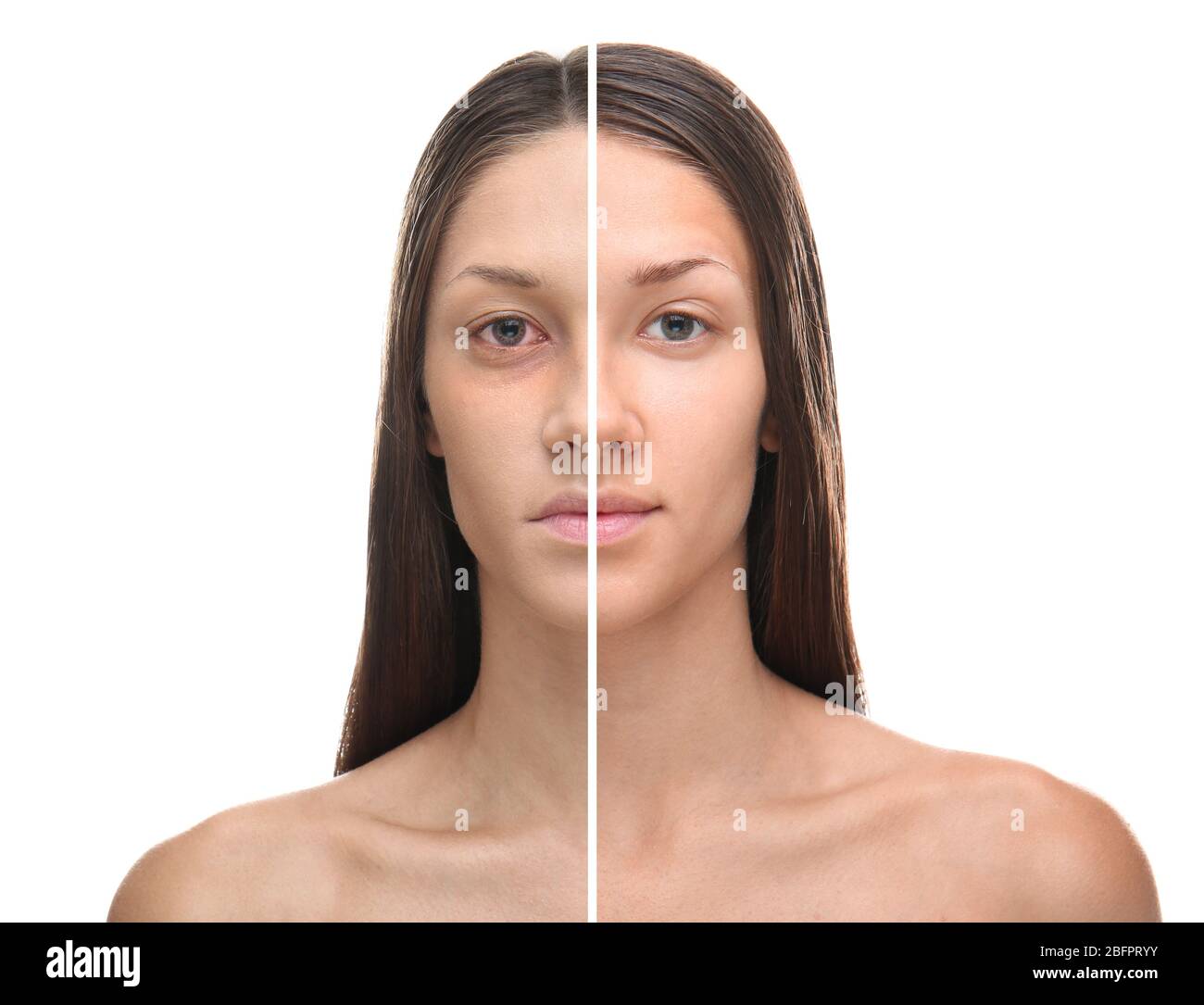 Young woman before and after exhaustion caused by sleep deprivation on