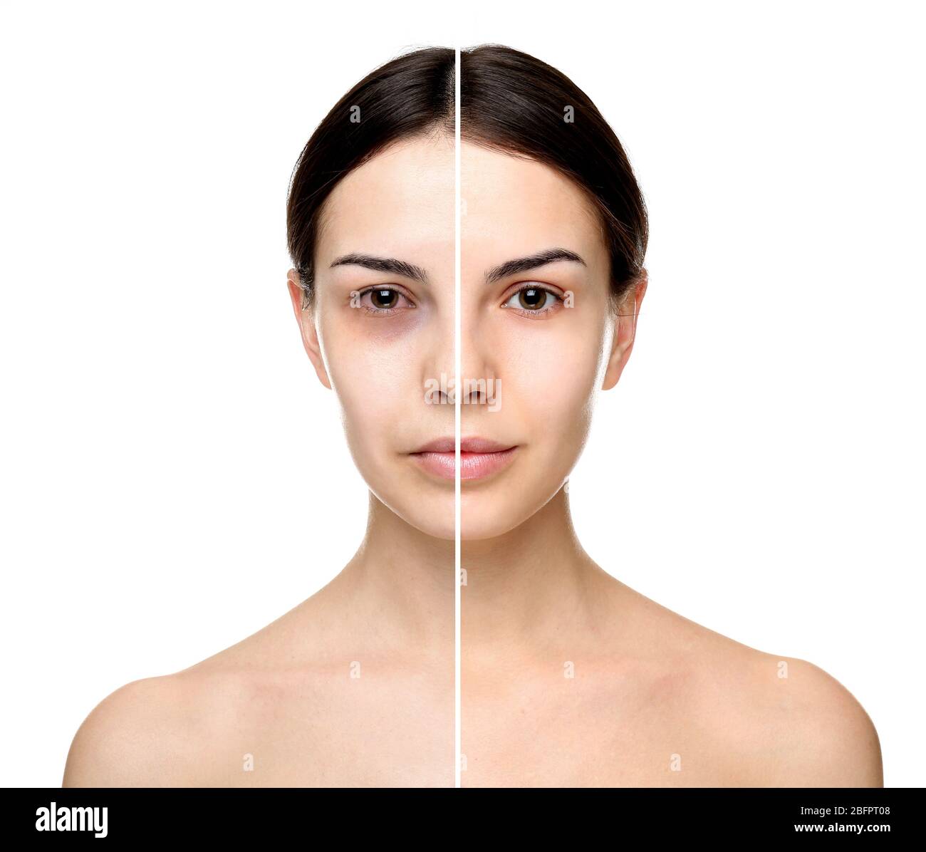 Young woman before and after exhaustion caused by sleep deprivation on