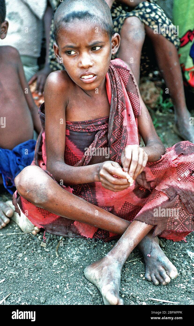 1992 - A Somali child waits for her allotment of food at a food delivery site set up during Operation Restore Hope relief efforts. (Baidoa Somalia) Stock Photo