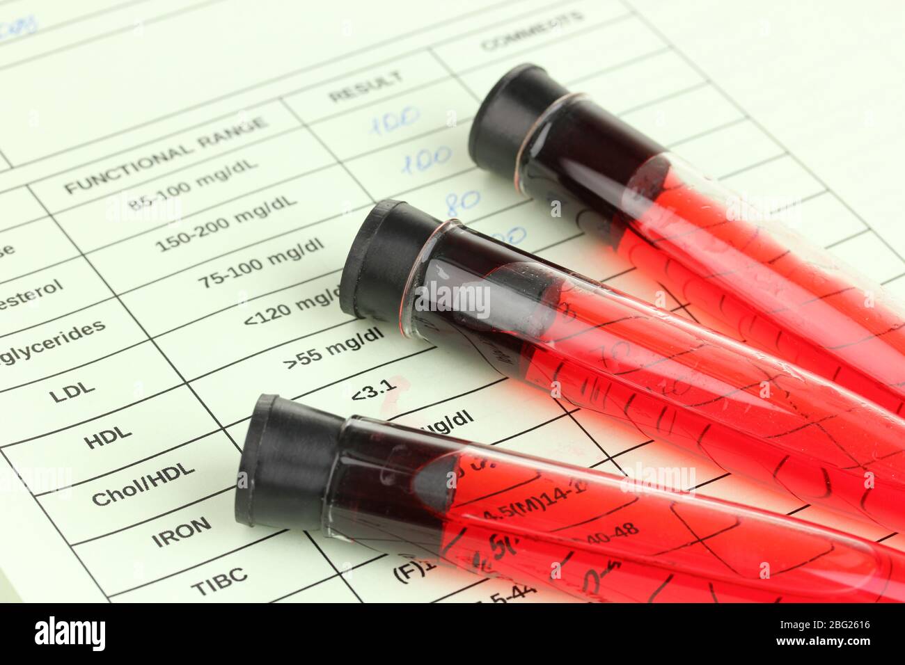 Blood in test tubes and results close up Stock Photo Alamy