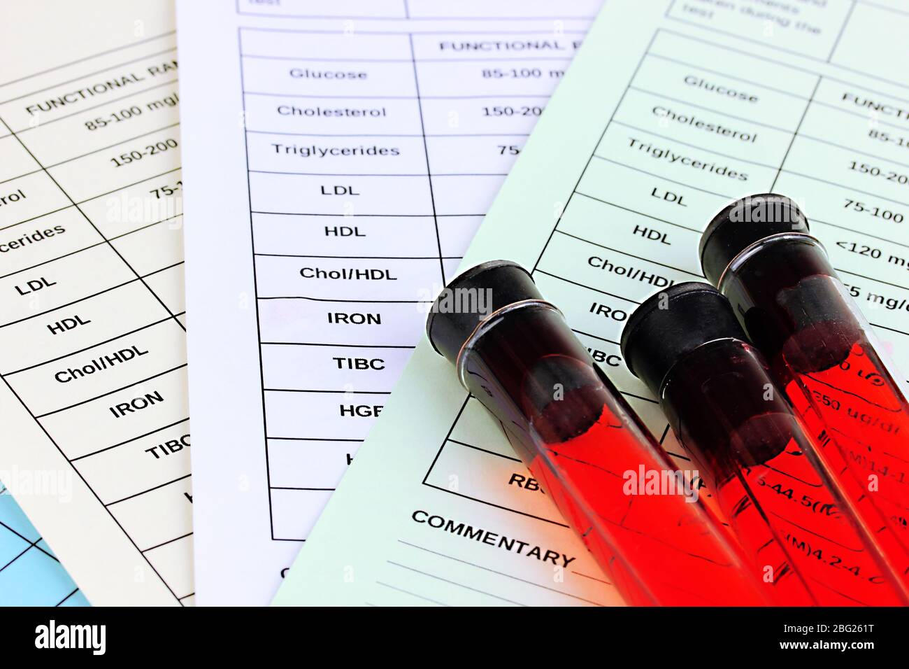 Blood in test tubes and results close up Stock Photo Alamy