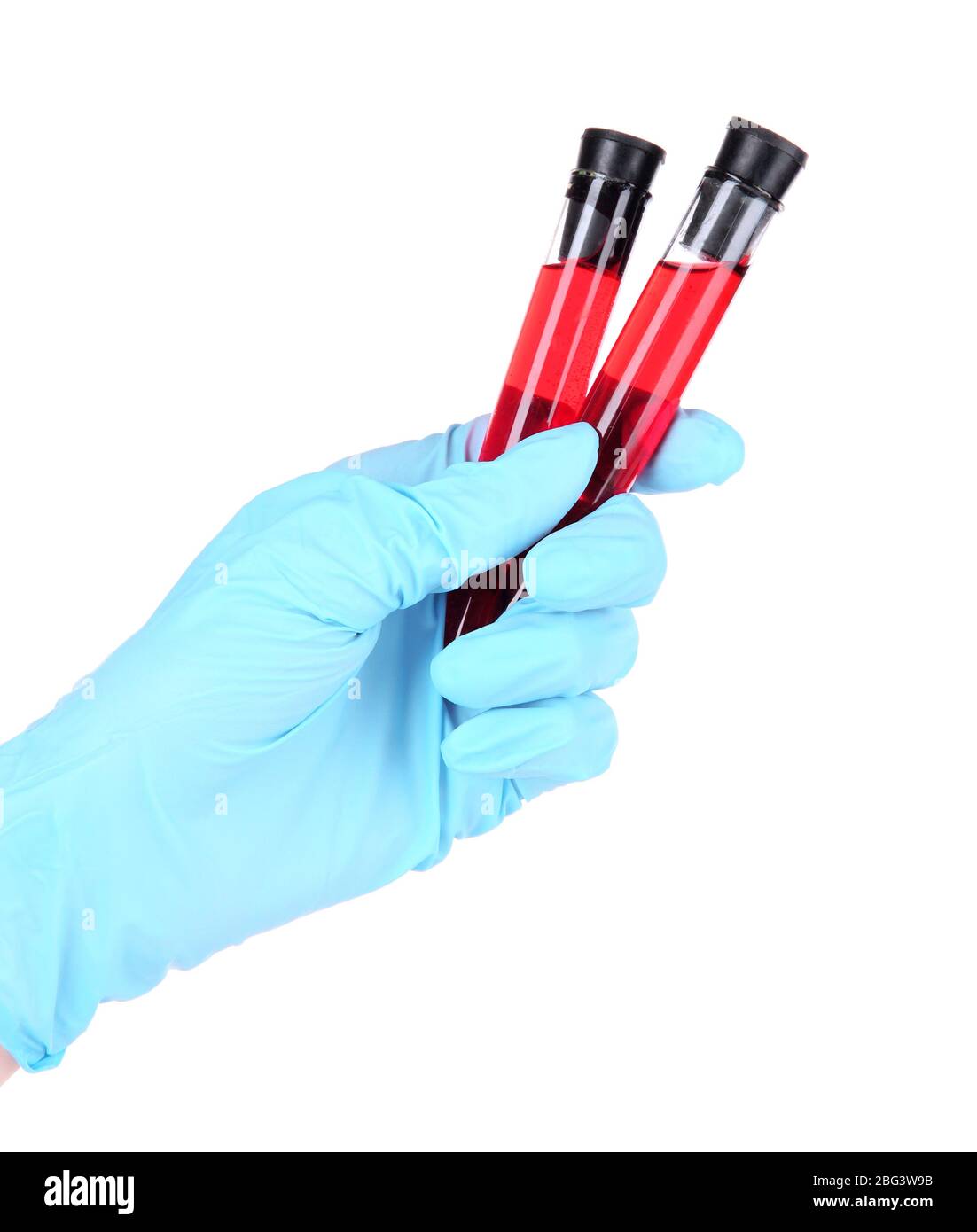 Test tubes with blood in hand isolated on white Stock Photo - Alamy