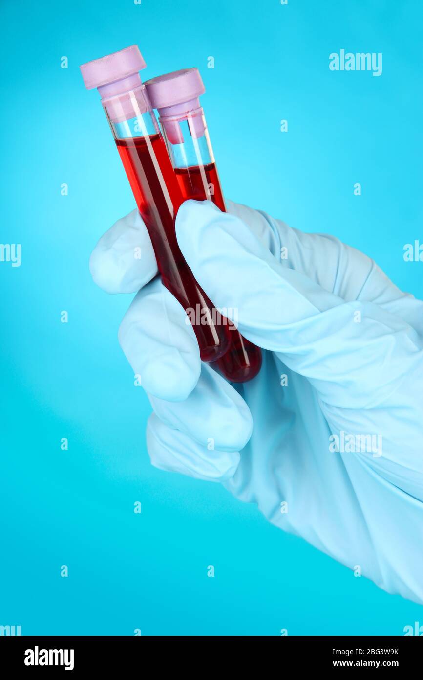Test tubes with blood in hand on blue background Stock Photo - Alamy