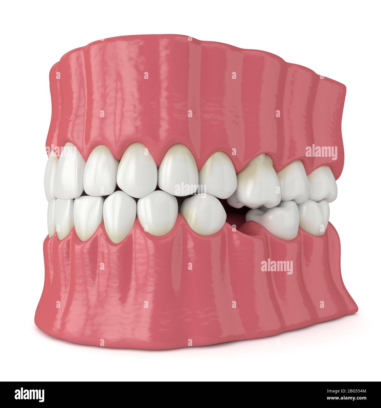 Protruding teeth hires stock photography and images Alamy