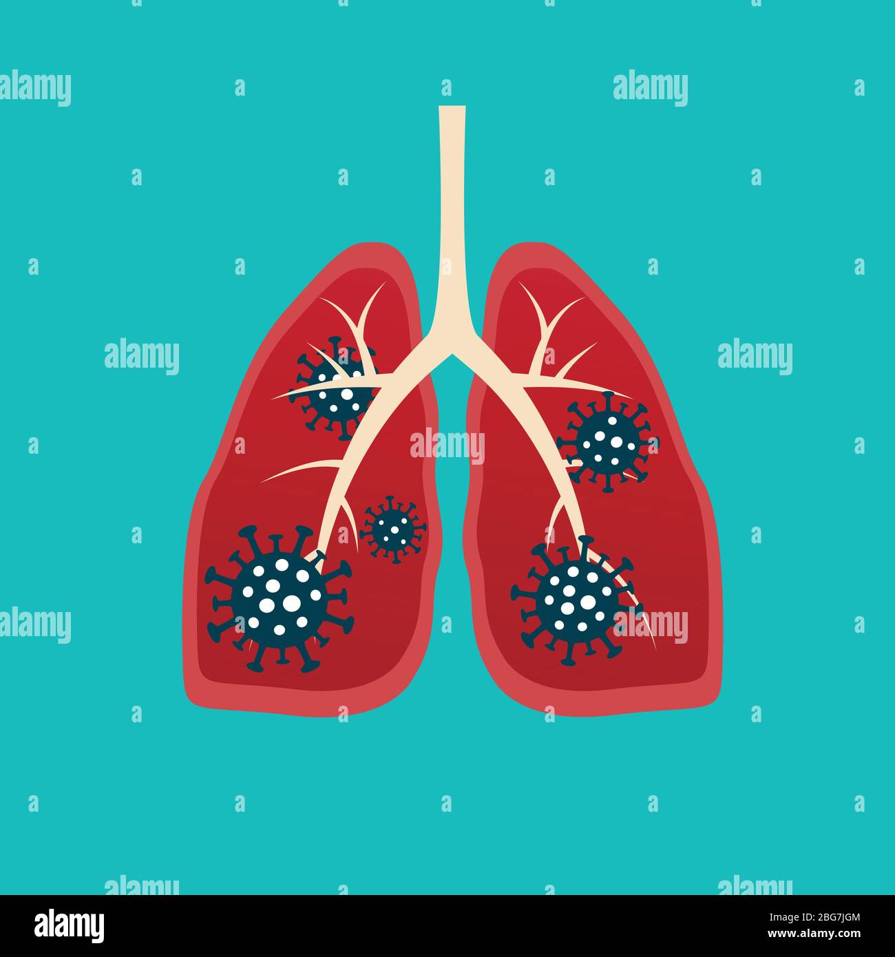 Virus cells eating lung. Virus cells biting lung. Damaged lung. Virus cell with scary and evil face. Coronavirus eating lung concept. COVID-19. 2019-n Stock Vector
