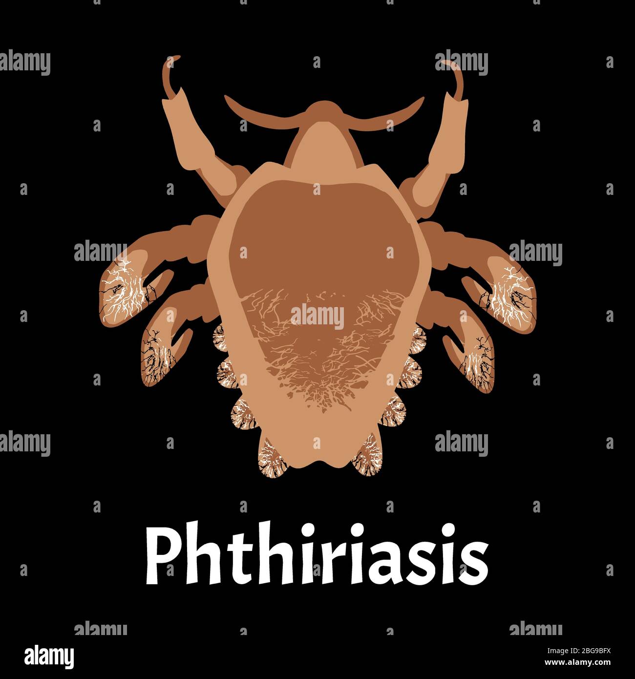Parasitic diseases of Phthiriasis. Pediculosis pubis. Pubic lice structure. Sexually transmitted diseases. Infographics. Vector illustration on Stock Vector
