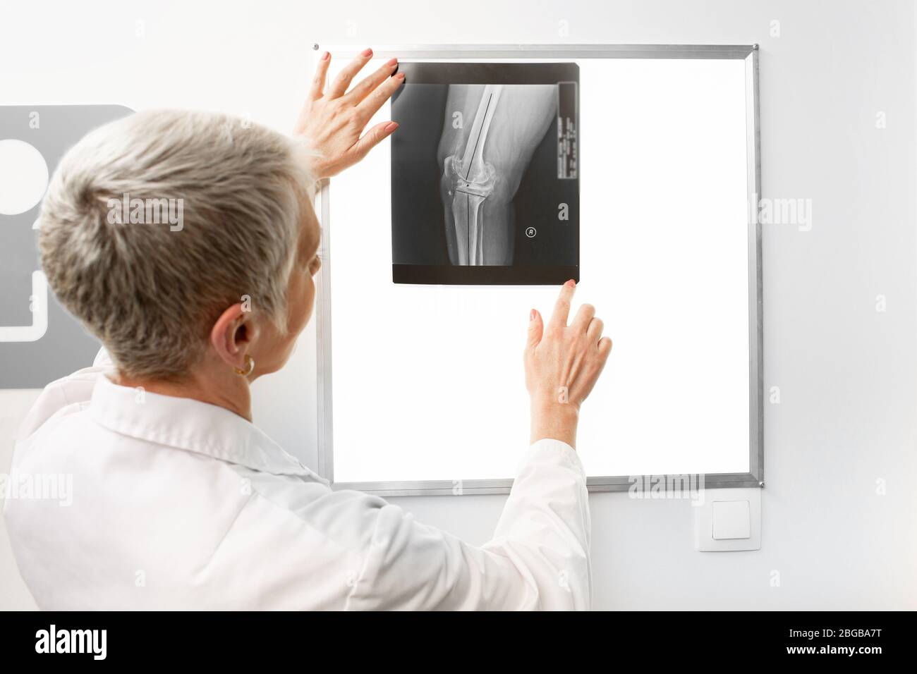 Mature doctor watching a knee x-ray on a negatoscope. Radiology Stock Photo