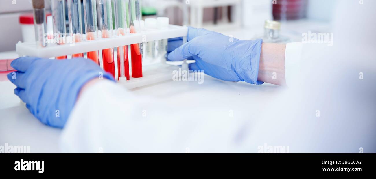 Medical technician holds vial of blood for automatic analyzer test of presence of antibodies in