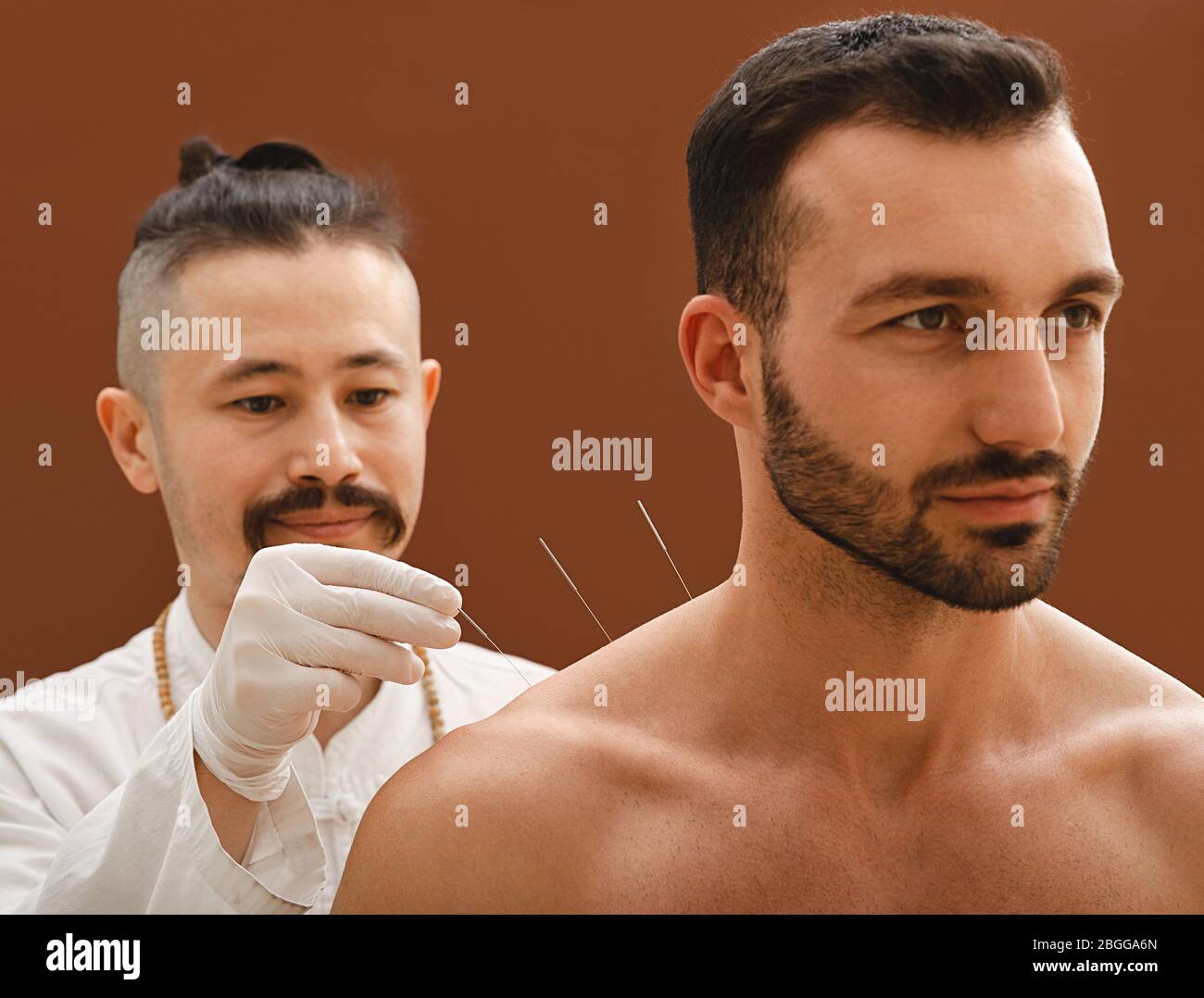 Acupuncturist inserts acupuncture needle into a man's shoulder that cures him of an illness. Acupuncture treatment of diseases. Stock Photo