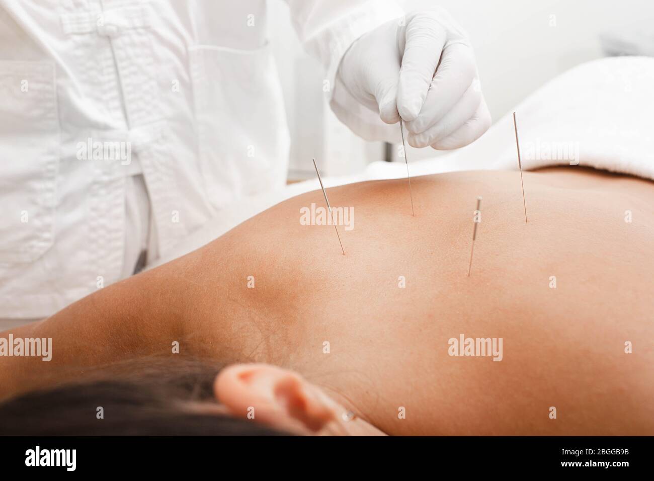 Osteochondrosis treatment with acupuncture. A woman in a spa salon treats her back with a certified reflexologist Stock Photo