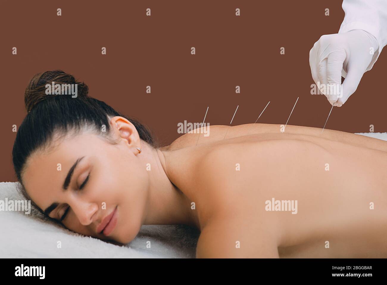 woman relaxes from acupuncture procedure. An acupuncturist doong acupuncture very accurately. Traditional chinese medicine Stock Photo