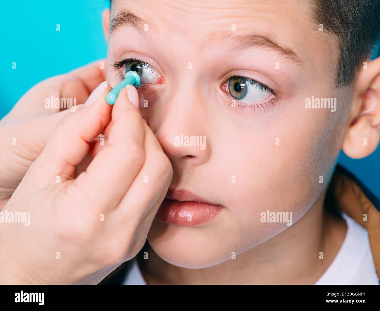 Optometrist trying on a contact lens to a teenage boy. Contact lenses