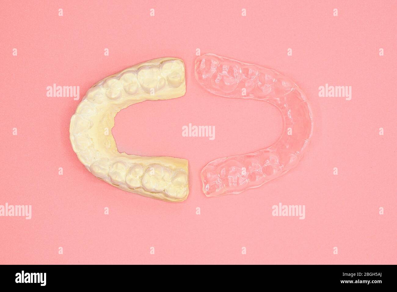Plaster impression of teeth. Dental plaster mold and orthodontic silicone trainer. Mobile
