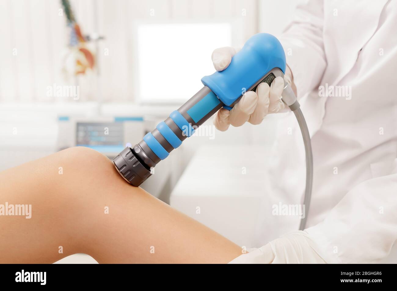 Extracorporeal Shockwave Therapy ESWT. Effective nonsurgical treatment