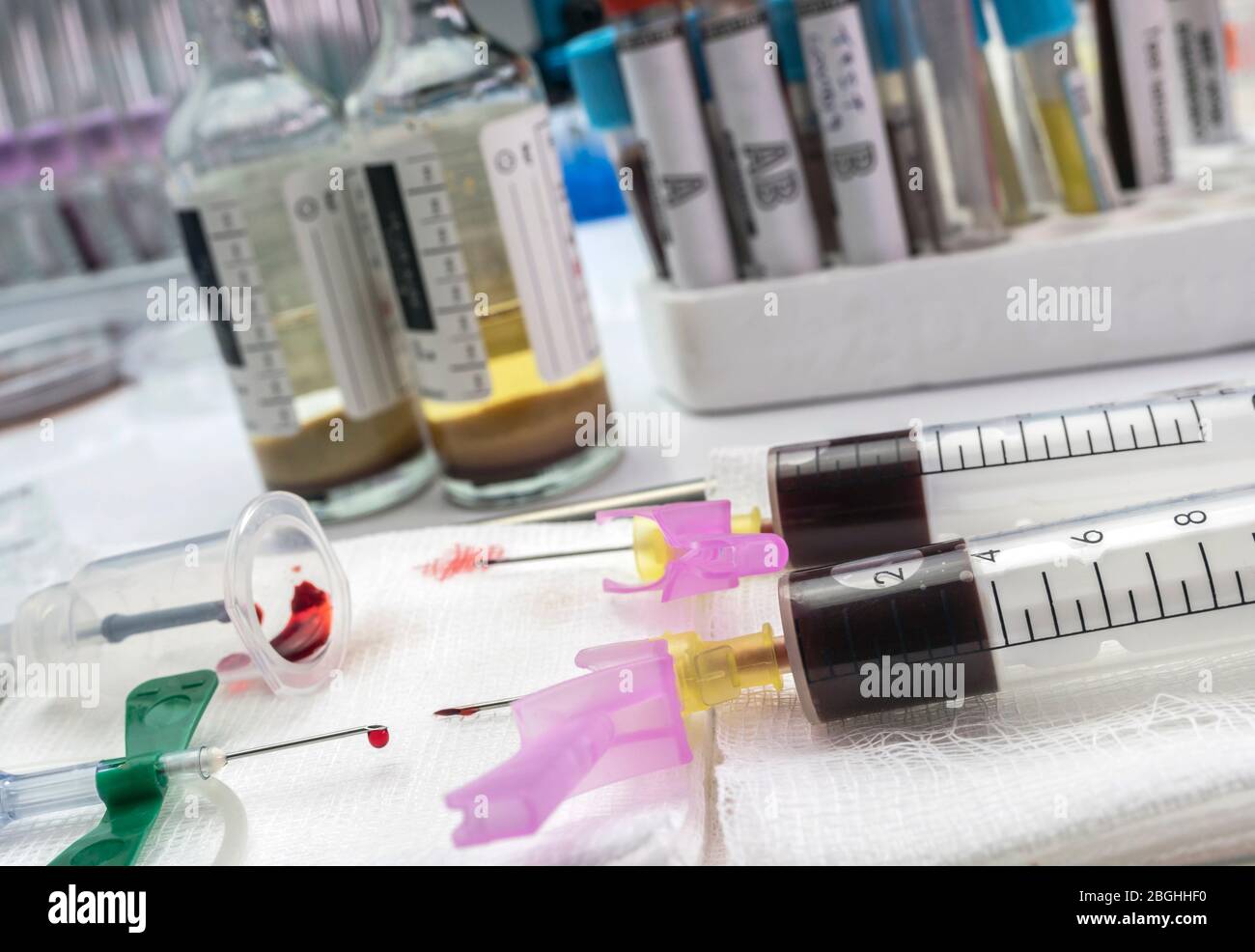 Aerobic and anaerobic blood culture sampling in a hospital, Spain Stock Photo