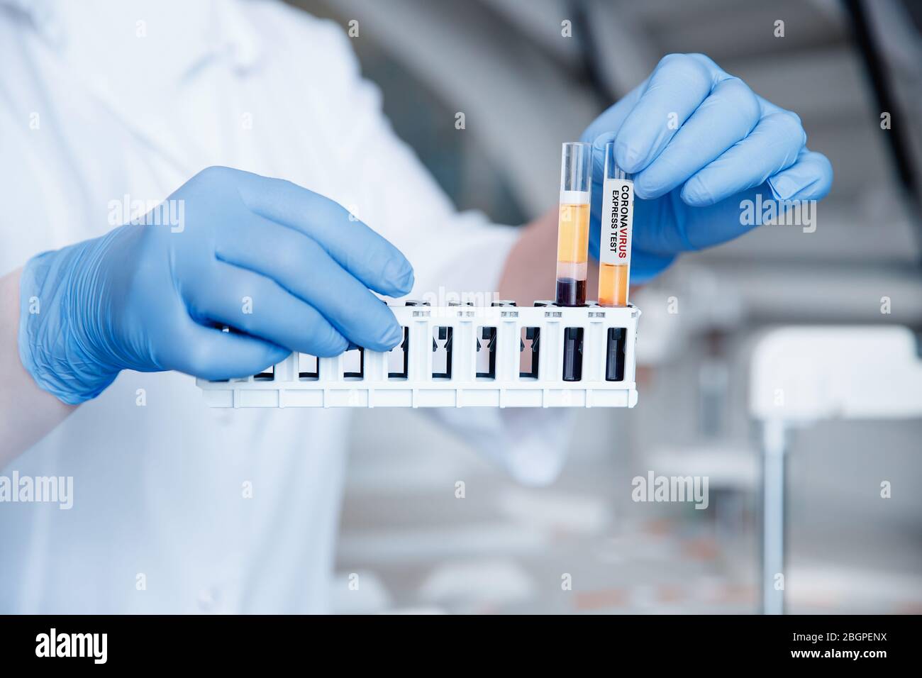 Bioengineer holds test tubes of blood samples for DNA analysis and