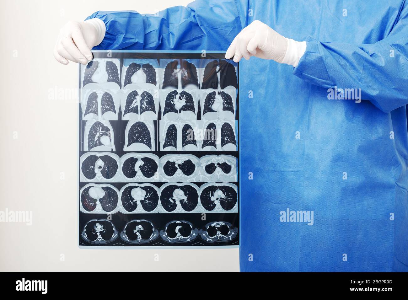 Lungs scan in Doctor hands. Surgeon in protective uniform check up MRI film. Coronavirus Covid 19, pneumonia, tuberculosis, lung cancer, respiratory Stock Photo