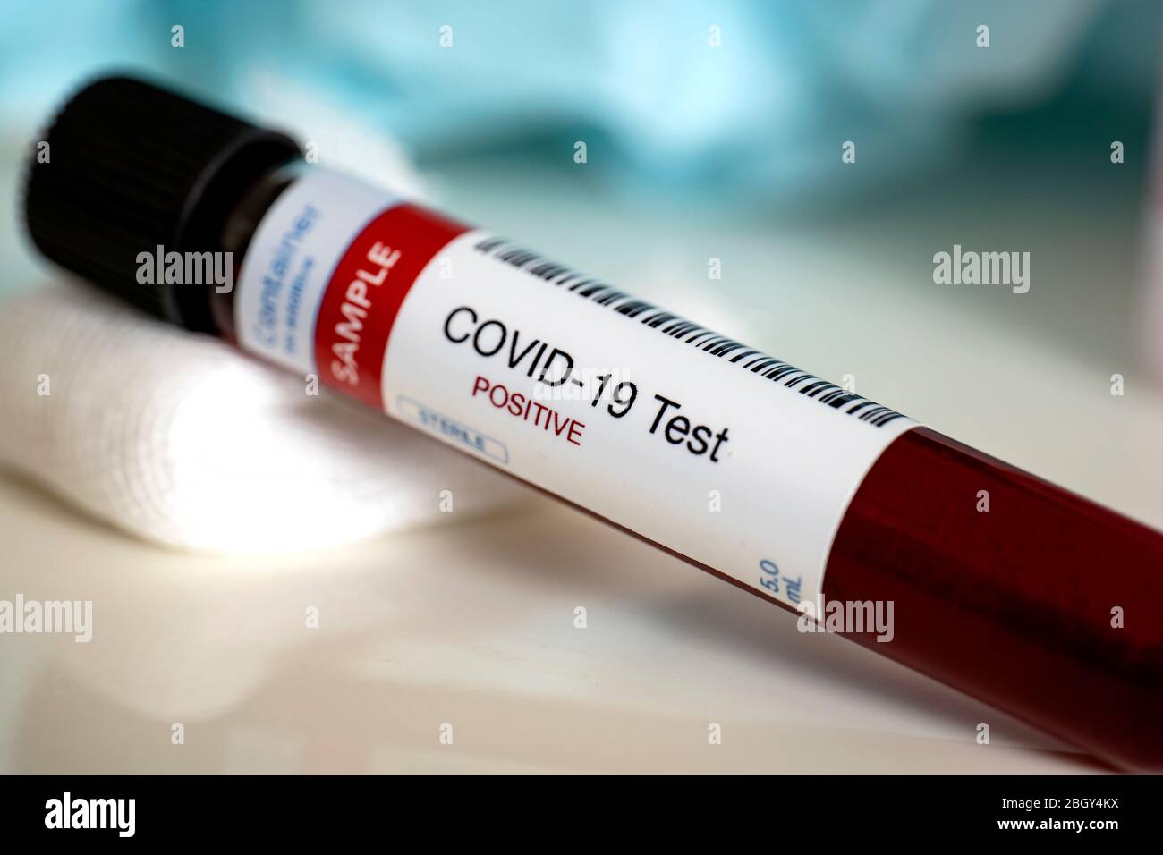 Blood test samples for presence of coronavirus (COVID-19) tube containing a blood sample that has tested positive for coronavirus. Stock Photo