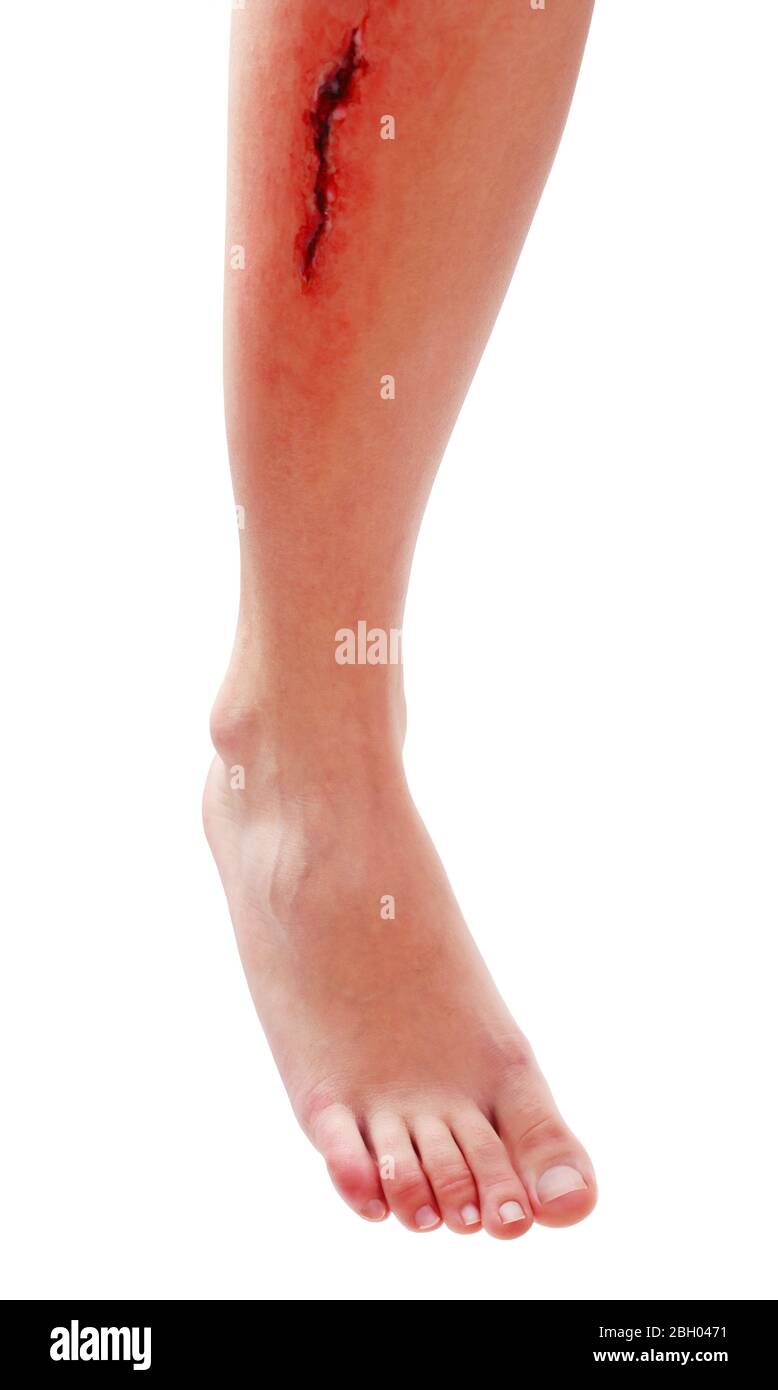 Injured leg with blood isolated on white Stock Photo - Alamy