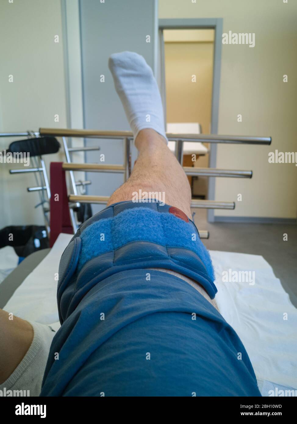 Отзывы после операции на суставе. Операция на коленный сустав. После операции на коленный.
