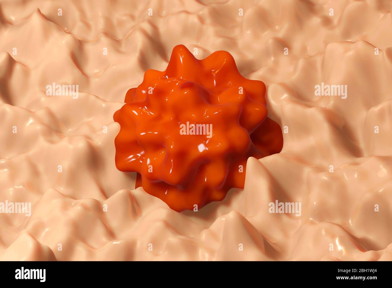 Three dimensional render of polyp growing on healthy tissue Stock Photo