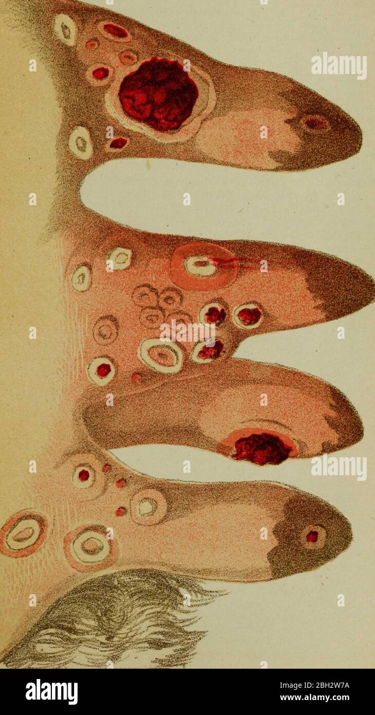 Illustration from the book 'Contagious and Infectious Disease: measures
