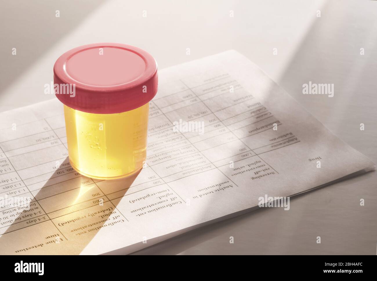 Urinalysis, Drug Testing, Drug. Plastic jars for medical tests.. Urine