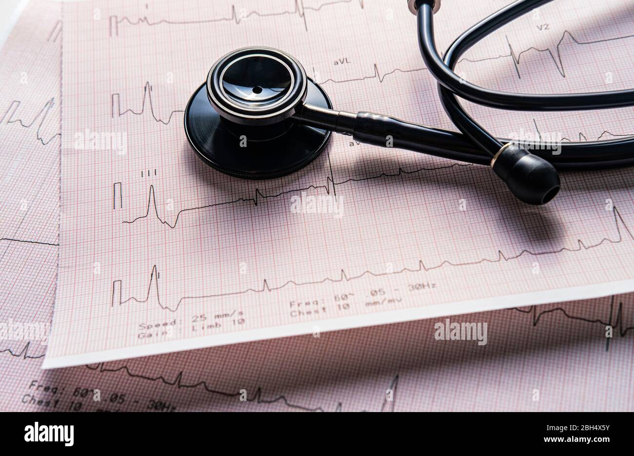 Stethoscope on electrocardiogram Stock Photo