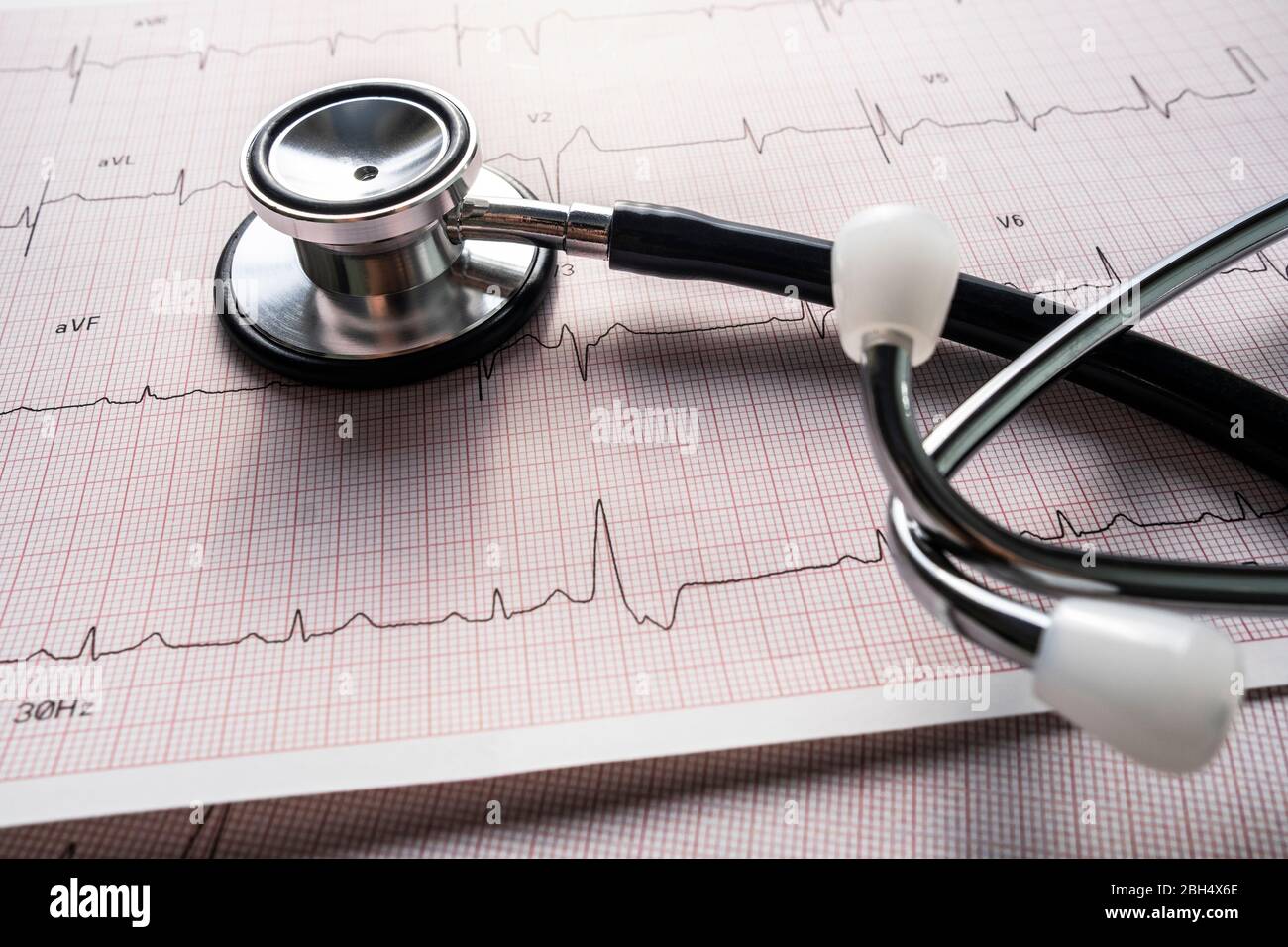 Stethoscope on electrocardiogram Stock Photo