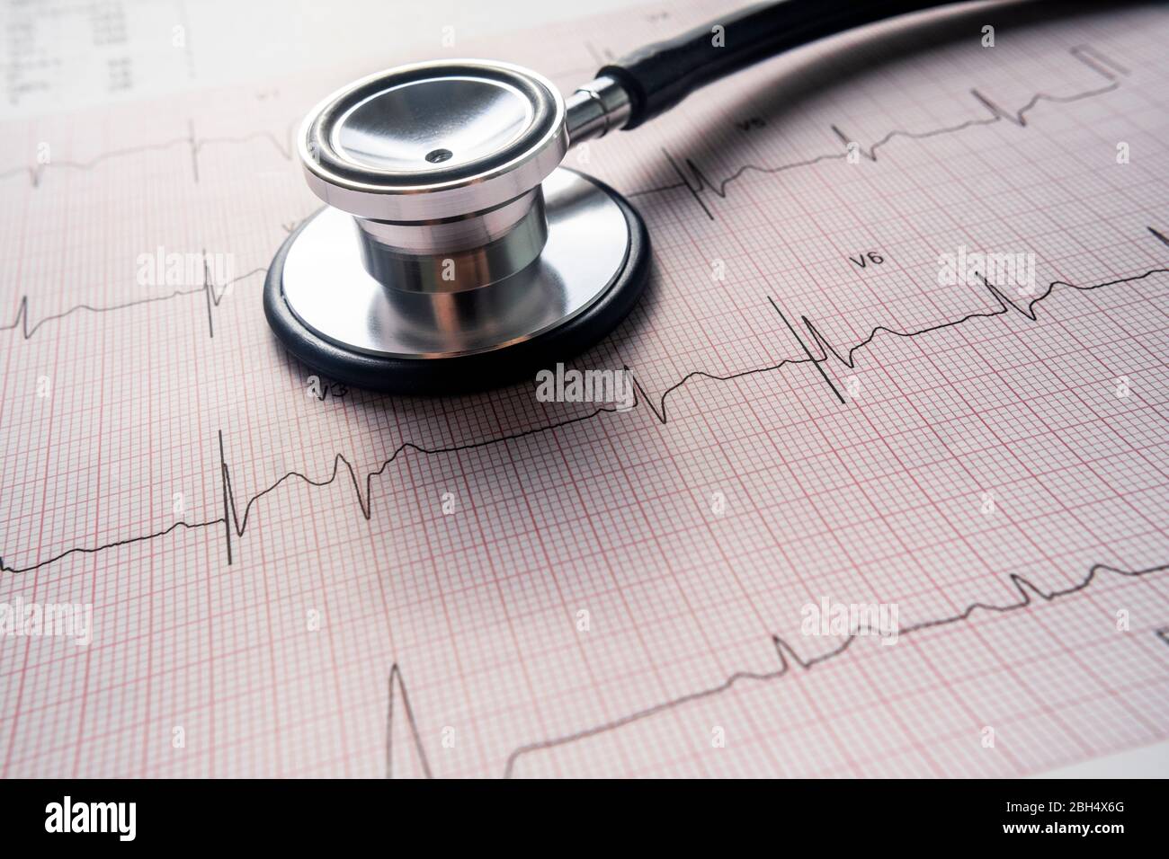 Electrocardiogram hi-res stock photography and images - Alamy