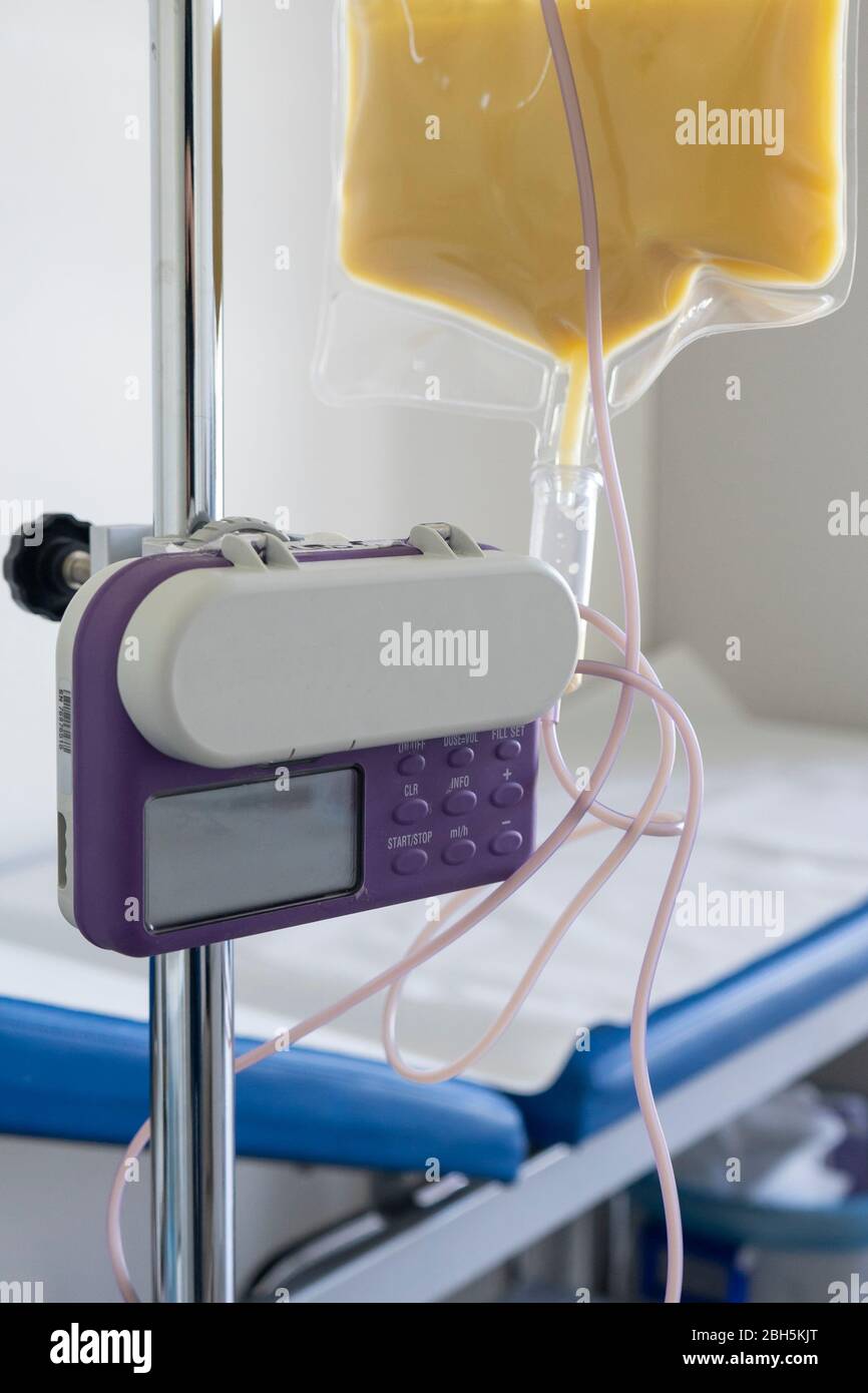 Feeding Pump medical device purple color to supplement nutrition liquid  food to tube enteral feeding fluid set bag with clamp hanging on stand  Stock Photo - Alamy