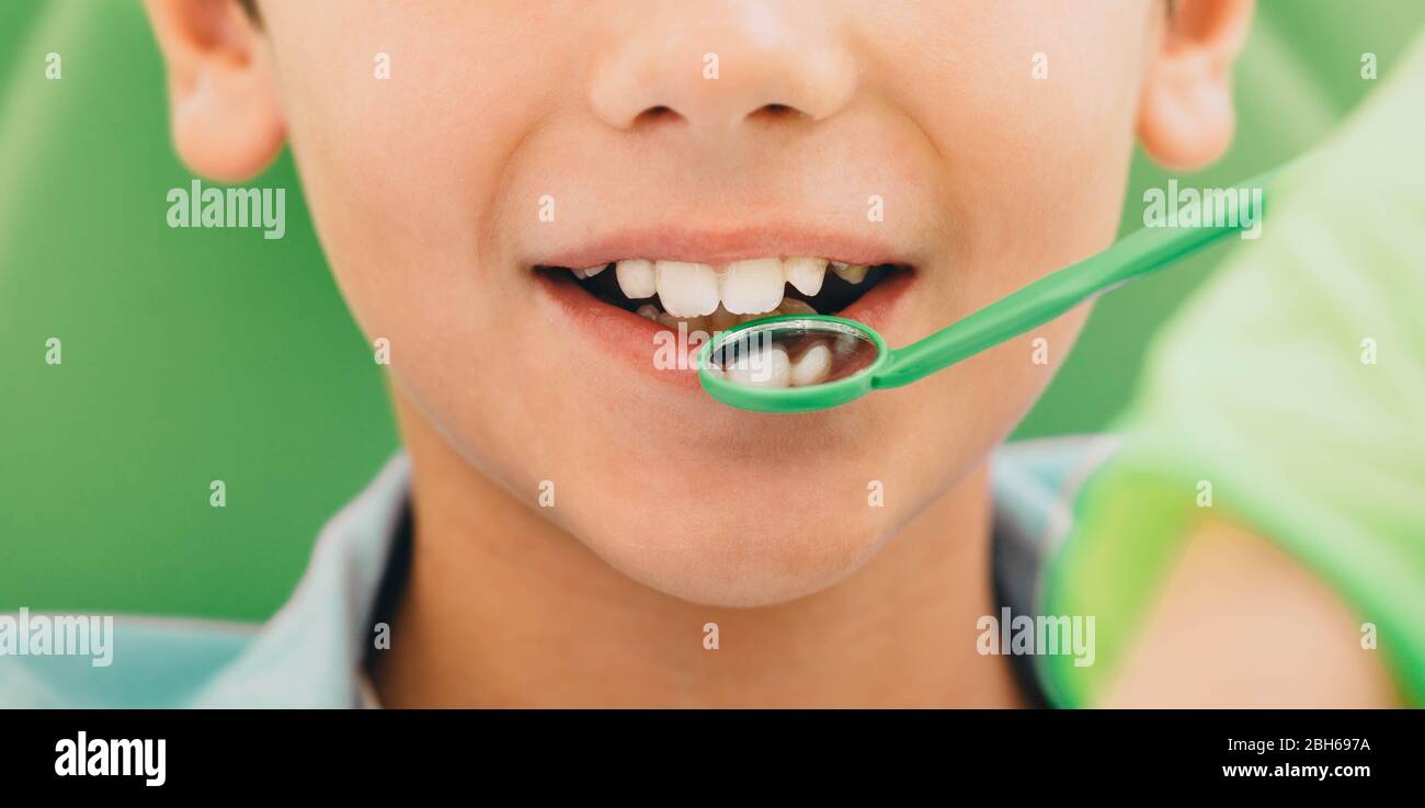 cropped child's smile while dental exam with dental mirror Stock Photo